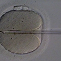 A human oocyte is held by a glass holding pipette (left). A beveled glass pipette containing an immobilized ejaculated spermatozoon is inserted through the zona pellucida and deep into the oolemma, creating a deep furrow. Once the membrane of the oocyte is penetrated, the sperm is deposited therein.